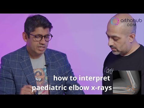 orthohub ODM: how to interpret paediatric elbow x-rays with Anish Sanghrajka – orthopaedic surgeons