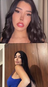 91K views · 542 reactions | People make assumptions about me because of my looks  #reels #viral #hookedonthelook #truly #plasticsurgery #cosmeticprocedures #assumptions | Hooked On The Look | Facebook