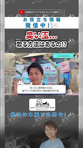 臭い玉..取る方法はある！？【北梅田ロワイヤルおとなこども歯科】 #歯医者#審美歯科#大阪歯医者#美容#dentist