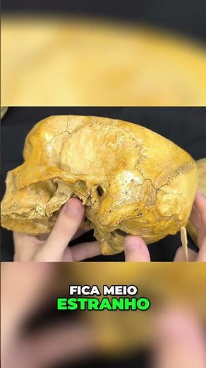 Anatomy of the Skull