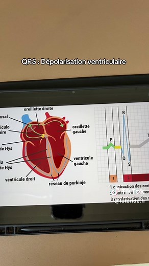 Interpréter un ECG en 2 minutes - Partie 2