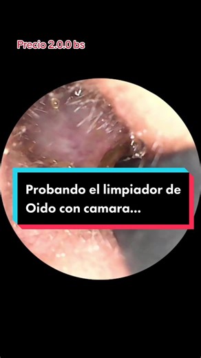 ¡Probando el nuevo limpiador de oído con cámara! ¡Quédate hasta el final!