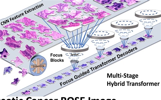 【论文分享】Advancing Pancreatic Cancer ROSE lmage Classifcation With MSHT
