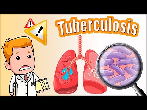 Tuberculosis (TB): symptoms, diagnosis (Mantoux) and treatment. Mycobacterium tuberculosis