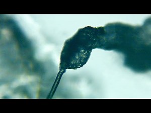 Microscope video of acne pimple zit pus dead white blood cells sebum Part 2 looks like snake tongue