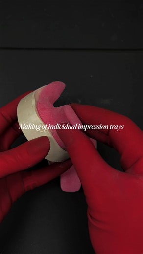 Making Custom Impression Trays: A Step-by-Step Guide