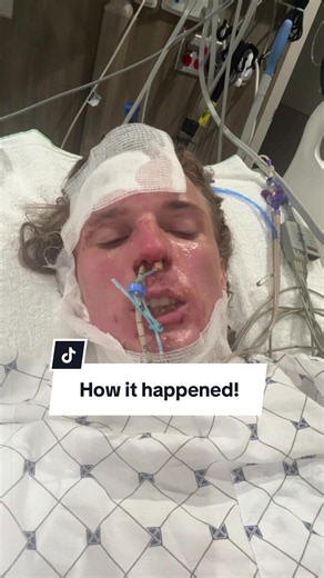 How to make this video while I was on the good meds😅. The go fund me link is in my bio. Thank you so much to everybody who’s donated/shared. Please feel free to ask any questions. #skidrow #sebastianbach #burnsurvivor #storytime