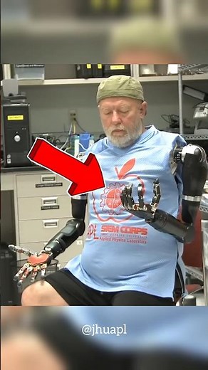 How Neural Impulse Controlled Bionic Arms Works #shorts #ramkarnan