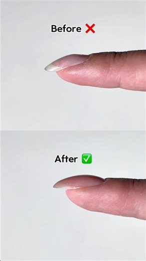 How to Fix Hook Nails (Claw Nails) | Easy At-Home Tutorial #nails #nailtutorial #nailhacks