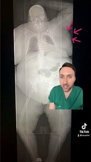 'BIG BONED' Myth DEBUNKED