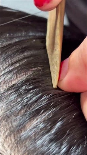 Which type of lice sound do you like? 🪲#PalmOil #HarvestLife #fieldwork