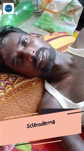 Dr Medica Clinical Cases || Scleroderma || Dermatology || Medical Knowledge || Medical Cases