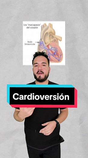 Lo que debes saber sobre la Cardioversión