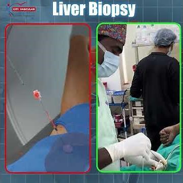 Liver Biopsy Procedure Explained | Is Liver Biopsy Painful? || Dr.Shaileshkumar Garge