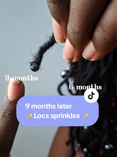 Loc Sprinkles Transformation: 9 Months Update