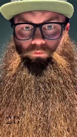 He hid behind that beard for years. Then the scissors came out… and wow. 😱 You won’t believe the man underneath. Watch the full transformation in the comments below👇👇 | Visal