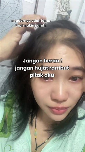 AHE Shampoo: Solusi Rambut Sehat dan Kuat