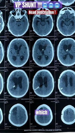 IMP 🥶🤯 #youtube #hospital #generalphysician #youtubeshorts #viral #viralvideo#science #viralshorts