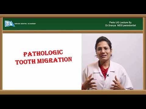 Trauma from occlusion and pathological migration