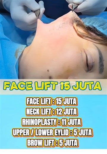 Dokter_Lee Wick on TikTok