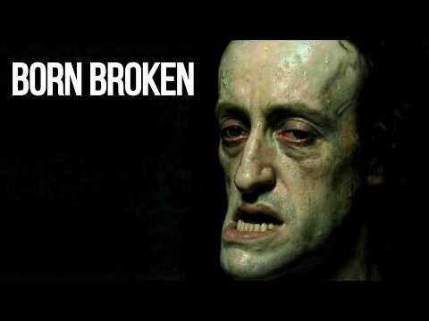 the Habsburg Jaw: A King Born Broken by His Own Family