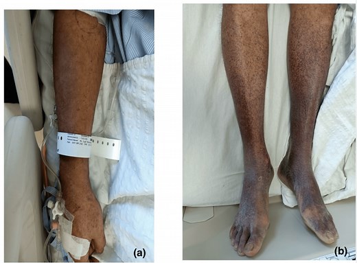 Health Minister: Applied Health Science Graduates Achieve Equality | The Seventh Day – Archyde