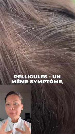 25 reactions | Comment ça se met en place Le stress fait monter le...
