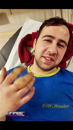 Frost Burn: A Gas Tank Destroyed My Hand in Seconds