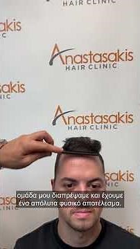 💇‍♂️ Απόλυτο makeover με FUE και 2200 τθ – Δείτε τη μεταμόρφωση! case #402