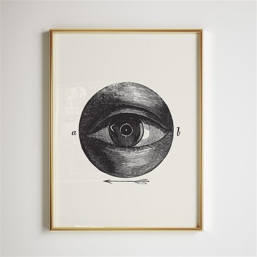 Weissenbruch Eye Print | Anatomical Chart Poster | Medical Illustration Ophthalmic | Digital Download - Etsy