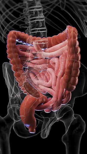medical_animation on Instagram: "🌿 Understanding Constipation: A Common Digestive Issue 🌿 Dive into the causes and effects of constipation, a prevalent condition that affects people of all ages. Learn about the factors that contribute to slowed bowel movements and the impact it can have on everyday wellness. Our detailed visuals and expert insights help demystify this common condition. Stay informed and take steps towards maintaining a healthy digestive system. Animation credit 📸- @sciepro.of