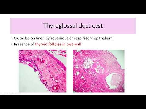 Lecture 02 Pathology Of Endocrine System I Thyroid Gland, Parathyroid Gland
