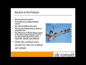 Fetal Acid Base Status and Umbilical Cord Sampling presented by Dr. David Acker