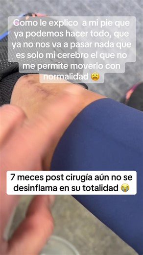 7 Months Post Ankle Surgery: The Healing Journey