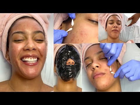 Gentle Acne Detox Facial | Glam By Lia Leigh