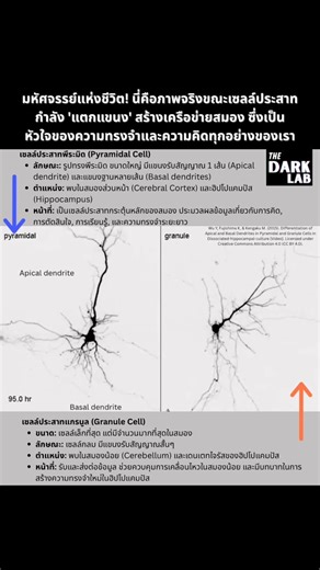 วิดีโอนี้แสดงกระบวนการที่เรียกว่า "Differentiation" หรือ การเปลี่ยนแปลงสภาพของเซลล์ประสาท เพื่อไปทำหน้าที่เฉพาะทางค่ะ โดยเน้นไปที่การเจริญของเดนไดรต์ (Dendrites) ซึ่งเป็นแขนงของเซลล์ประสาทที่ทำหน้าที่รับสัญญาณจากเซลล์ประสาทอื่นๆ ▪️Pyramidal Cell (เซลล์ประสาทพีระมิด): เป็นเซลล์ประสาทชนิดหลักในสมองส่วนซีรีบรัลคอร์เทกซ์ (Cerebral Cortex) และฮิปโปแคมปัส (Hippocampus) มีลักษณะเด่นคือตัวเซลล์ (Soma) เป็นรูปทรงสามเหลี่ยมคล้ายพีระมิด และมีการแตกแขนงของเดนไดรต์ 2 รูปแบบที่ชัดเจนคือ: • Apical Dendrite: เด