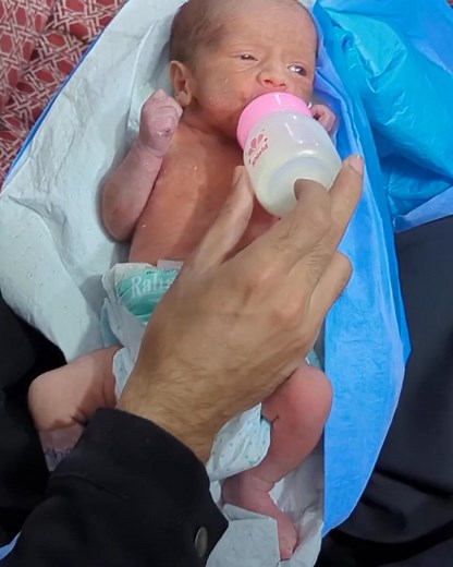 27K views · 987 reactions | Feeding a premature baby is one of the...