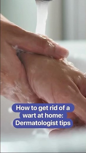 How to get rid of a wart at home: Dermatologist tips