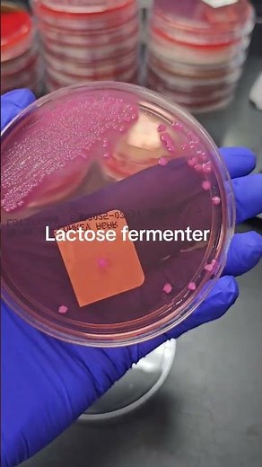 E. coli in a urine culture. #escherichiacoli #microbiology #microbiologist #labtech #nursing #mls