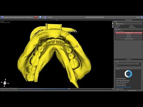 CBCT to Surgical Guide Training Video - Using the Impression Inversion Protocol