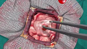 CAE Healthcare NeuroVR Surgical Simulator