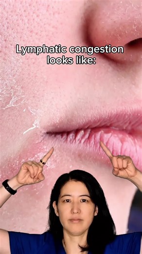 Most people think “puffiness” or “bloating” is just water weight… but lymphatic congestion shows up in so many ways: -swelling in legs/face -heavy, tired body -skin texture changes -constant fatigue brain fog -frequent colds -bloating after almost every meal -puffy eyes in the morning Your lymphatic system is your drainage system. If it’s backed up, everything feels slow, swollen, and stagnant. Hydration, gentle movement, walking, breathwork, warm foods, and self-massage help but when congestion