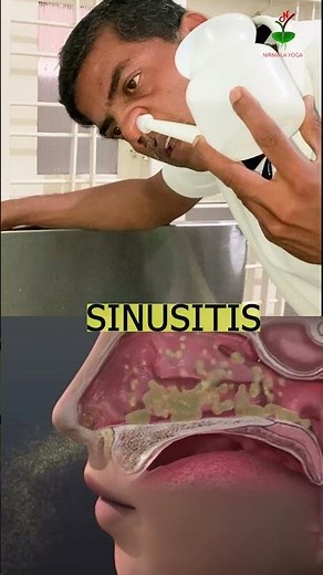 3 Benefits of Ancient Indian Nasal Cleaning Technique : JALA NETI