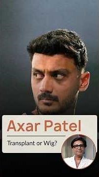 Axar Patel Hair Transplant | Celebrity Hair transplants Explained By Dr Shail | Satya Skin and Hair
