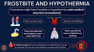 A dark blue graphic titled “Frostbite and Hypothermia” explains what to do if someone may have either condition. A highlighted box reads: “If someone might have frostbite or hypothermia, seek medical attention immediately!” The graphic includes illustrations of people in cold weather, a hoodie on a clothesline, a person wrapped in a blanket, and a hand under running water. Safety steps are listed in rounded boxes: “Get to a warm area,” “Remove wet clothing,” “Place skin affected by frostbite in 