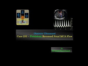 Ultrasound Case 231 - Persistent Reversed Fetal MCA Flow
