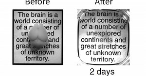 Researchers turn gray matter transparent to shed light on the brain’s secrets