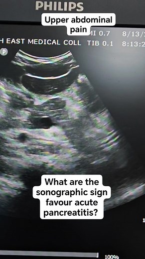 30K views · 176 reactions | #acutepancreatitis #sonographiccasestudy #radiology #education #learning #sonography #ultrasound #community #reelsvideo #reelsfacebook | Sonographic case study | Facebook