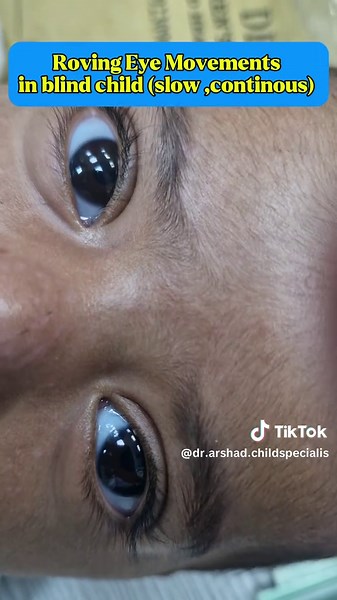 Roving Eye Movements Explained