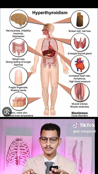 Understanding Hyperthyroidism: Causes and Treatments